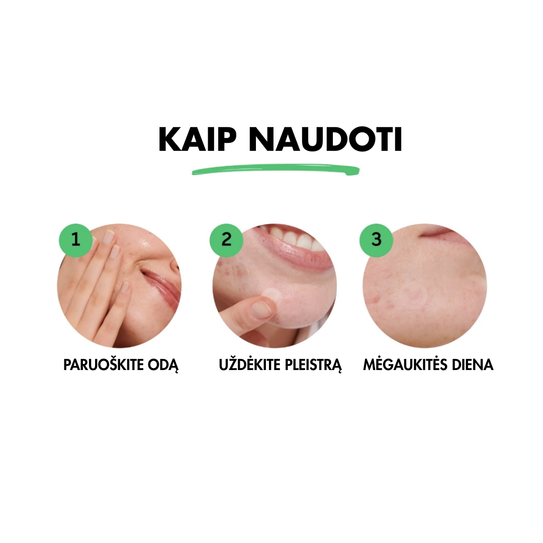 Grajva - Spuogų Pleistras